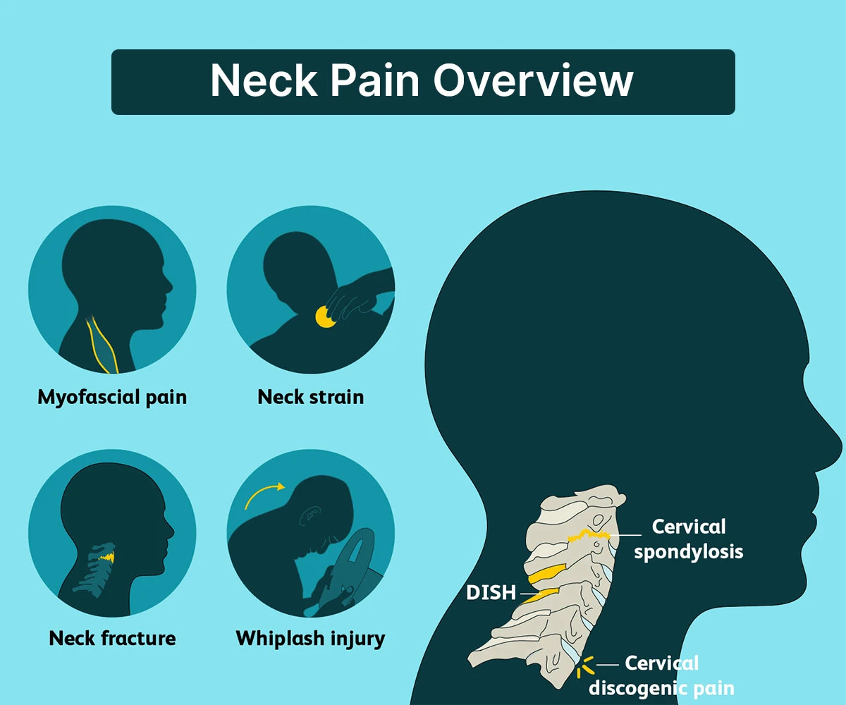 neck-pain-treatment-overview neck-pain-treatment-overview