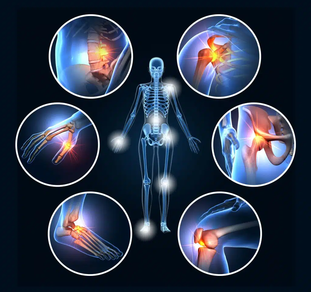 Top 10 Benefits of Physiotherapy for Chronic Pain Relief 1 Chronic pain treatment by healyos 6450ea8dc Top 10 Benefits of Physiotherapy for Chronic Pain Relief