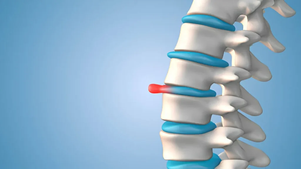 What is Sciatica? Causes, Treatments, and Pain Relief Tips 1 GetPaidStock.com 67dbe4f37c44c What is Sciatica? Causes, Treatments, and Pain Relief Tips