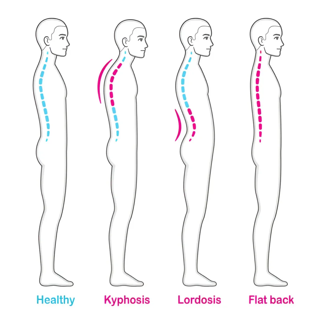 Physical Examination Techniques for Diagnosing Back Pain 2 steptodown.com363973 Physical Examination Techniques for Diagnosing Back Pain